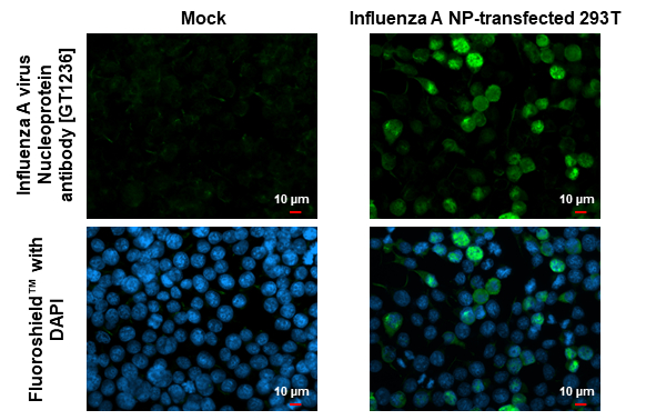 Anti-Influenza A virus Nucleoprotein antibody [GT1236] (GTX629633